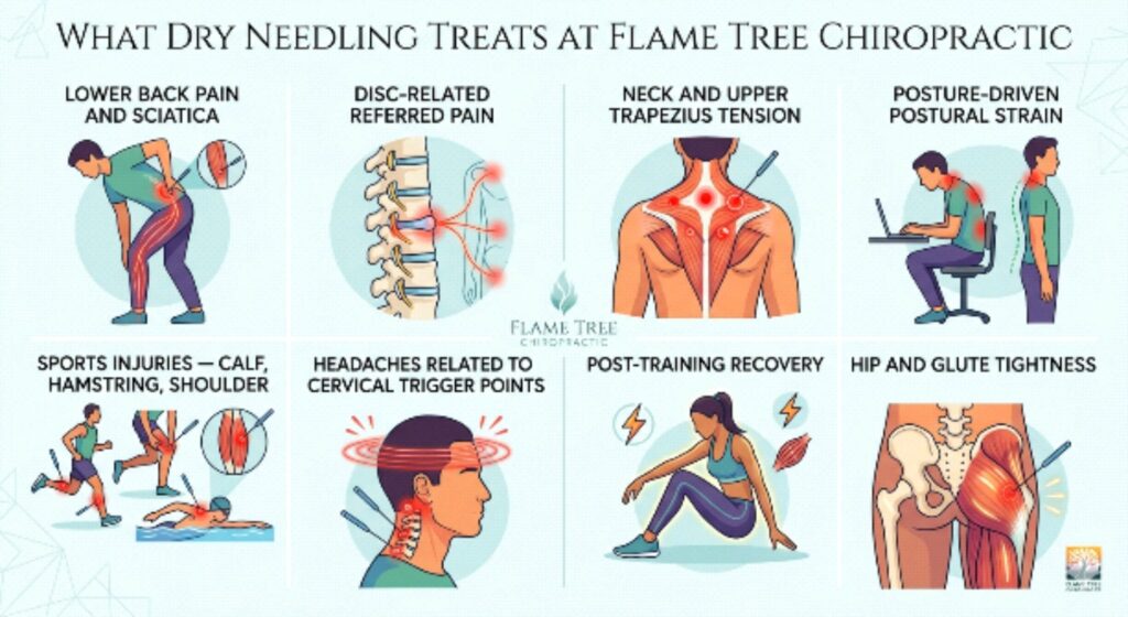 WHAT DRY NEEDLING TREATS AT FLAME TREE CHIROPRACTIC